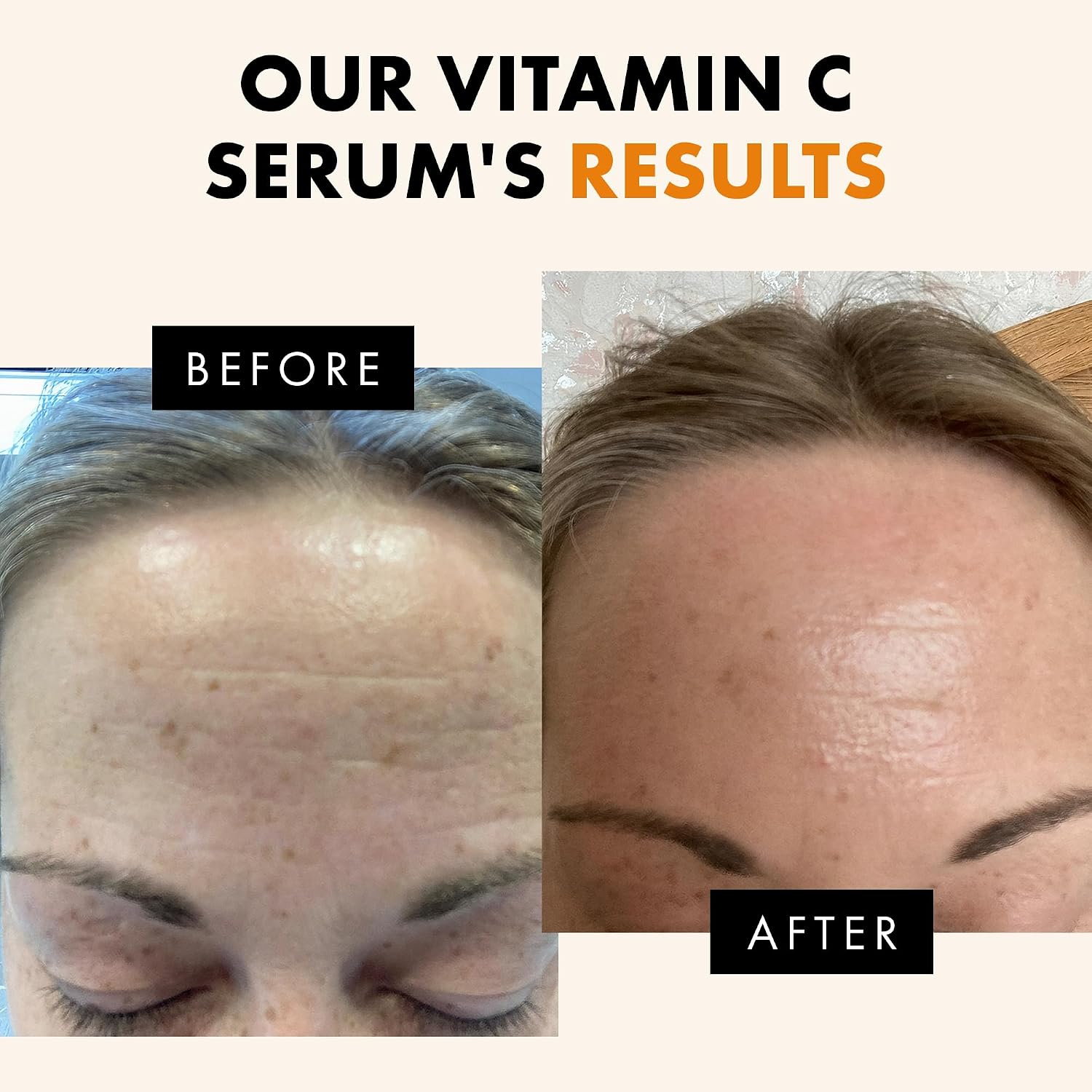 Vitamin C Serum - Skin Care for Dark Spots, Vitamin C Serum for Face with Hyaluronic Acid, Ferulic Acid, & Vit E