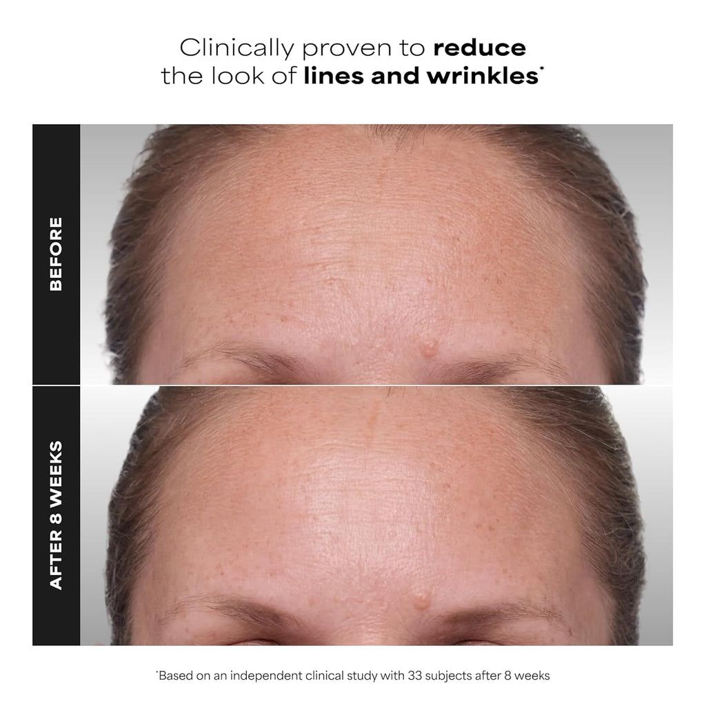 Paula's Choice CLINICAL 1% Retinol Face Treatment with Peptides | Anti-Aging Face Serum with Vitamin C & Licorice