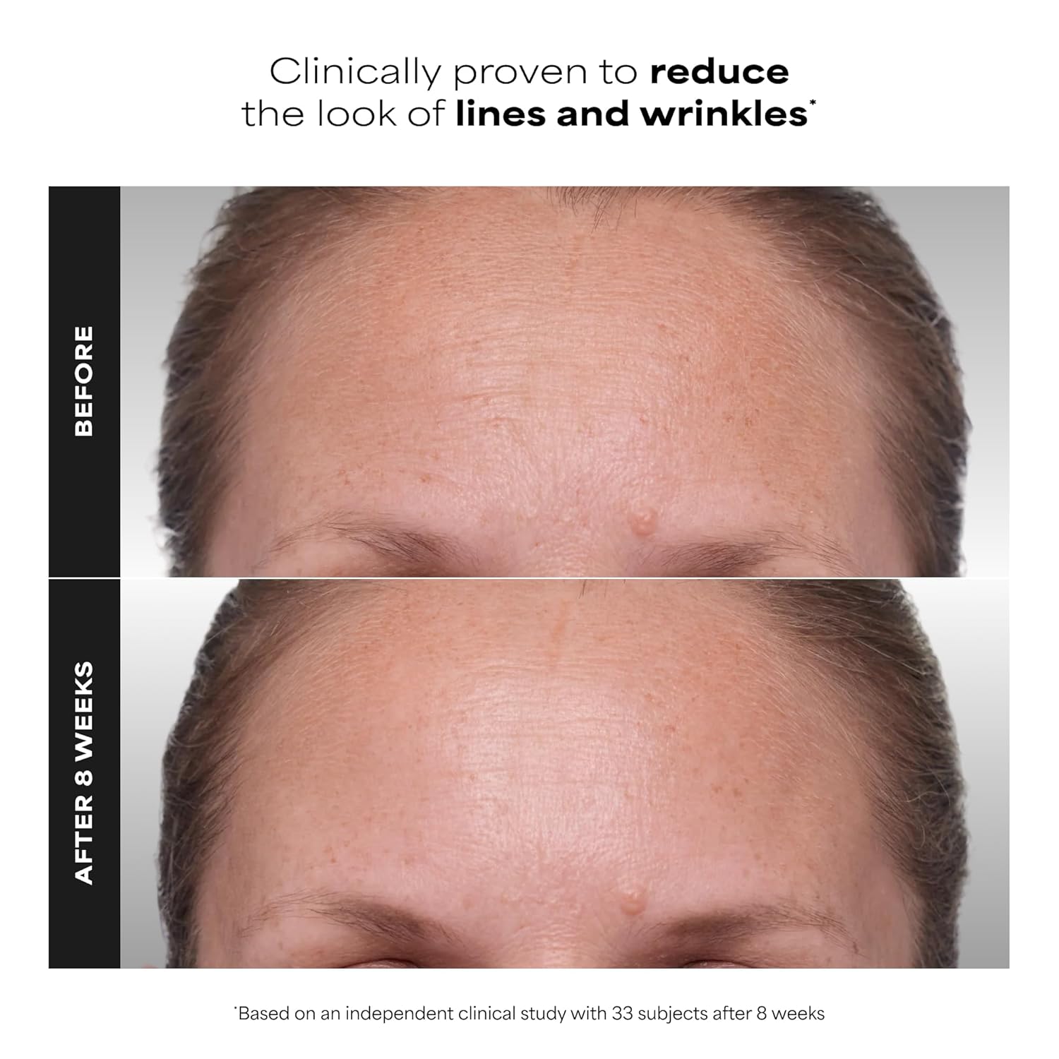 Paula's Choice CLINICAL 1% Retinol Face Treatment with Peptides | Anti-Aging Face Serum with Vitamin C & Licorice