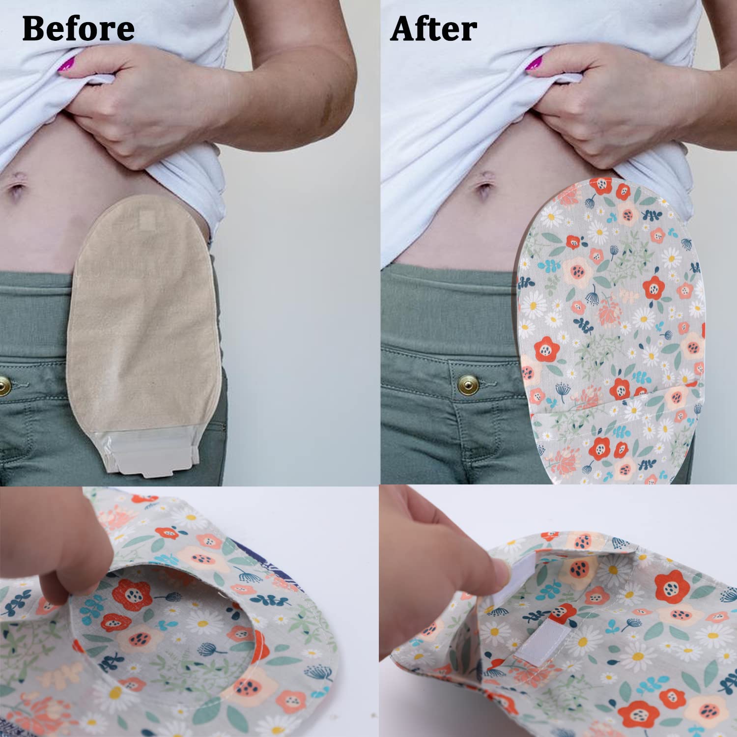 Ostomy Bag Covers - 3pcs Colostomy Bag Covers Odor Reducing Ostomy Pouch Covers, 3 inch Round Opening Colostomy Bag