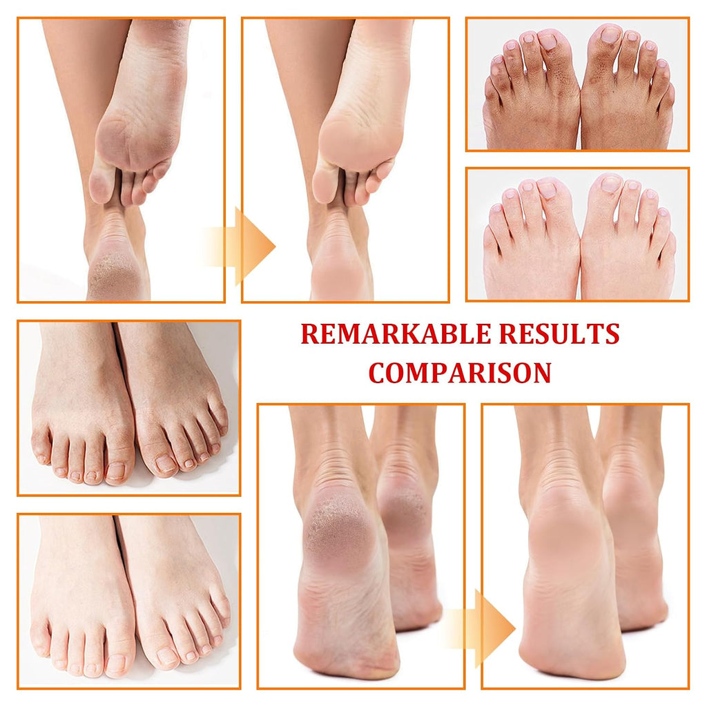 Foot Peeling Spray Oil,Moisturizing Nourishing Foot Exfoliating Peeling Spray,Instantly Hydrating Gently Foot Peel