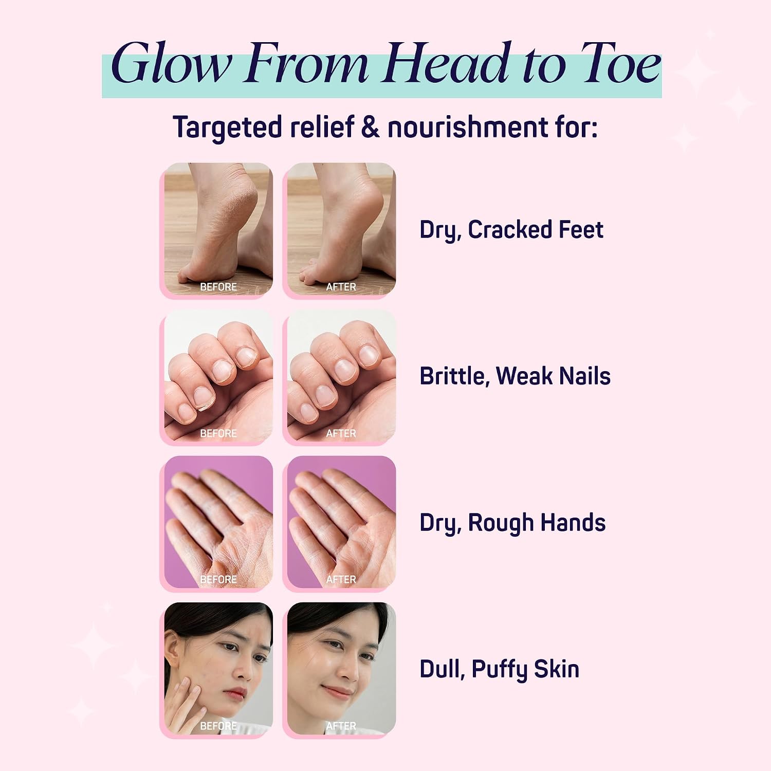 10 Piece Korean Face Mask & Moisturizing Hand Gloves Set | Foot Mask Socks for Dry Cracked Hands & Feet | Korean
