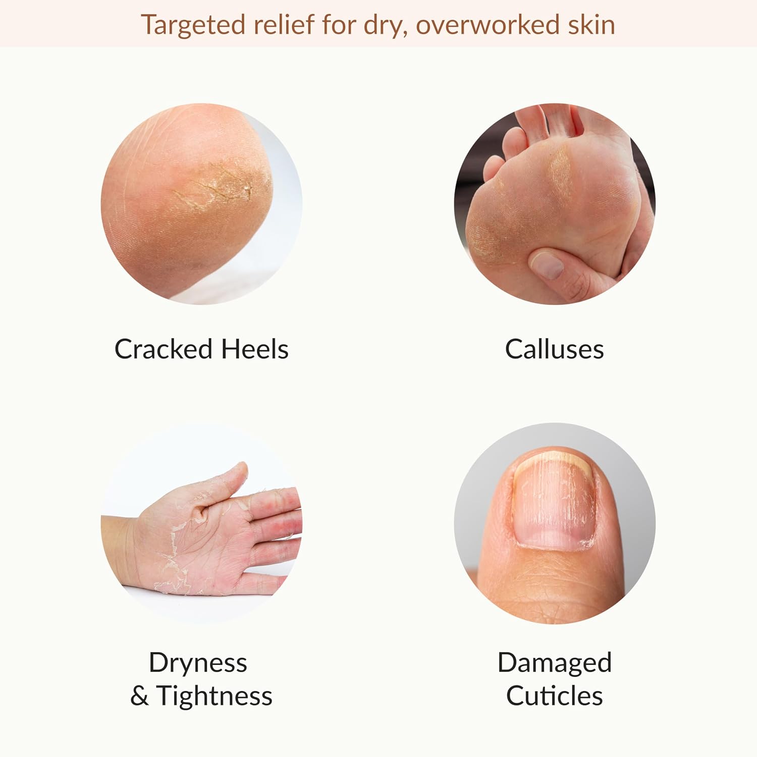 Hydrating & Moisturizing Hand & Foot Masks, Relieve and Soften Dry, Rough Skin, Self Care Gifts for Women, Spa Kit, 6