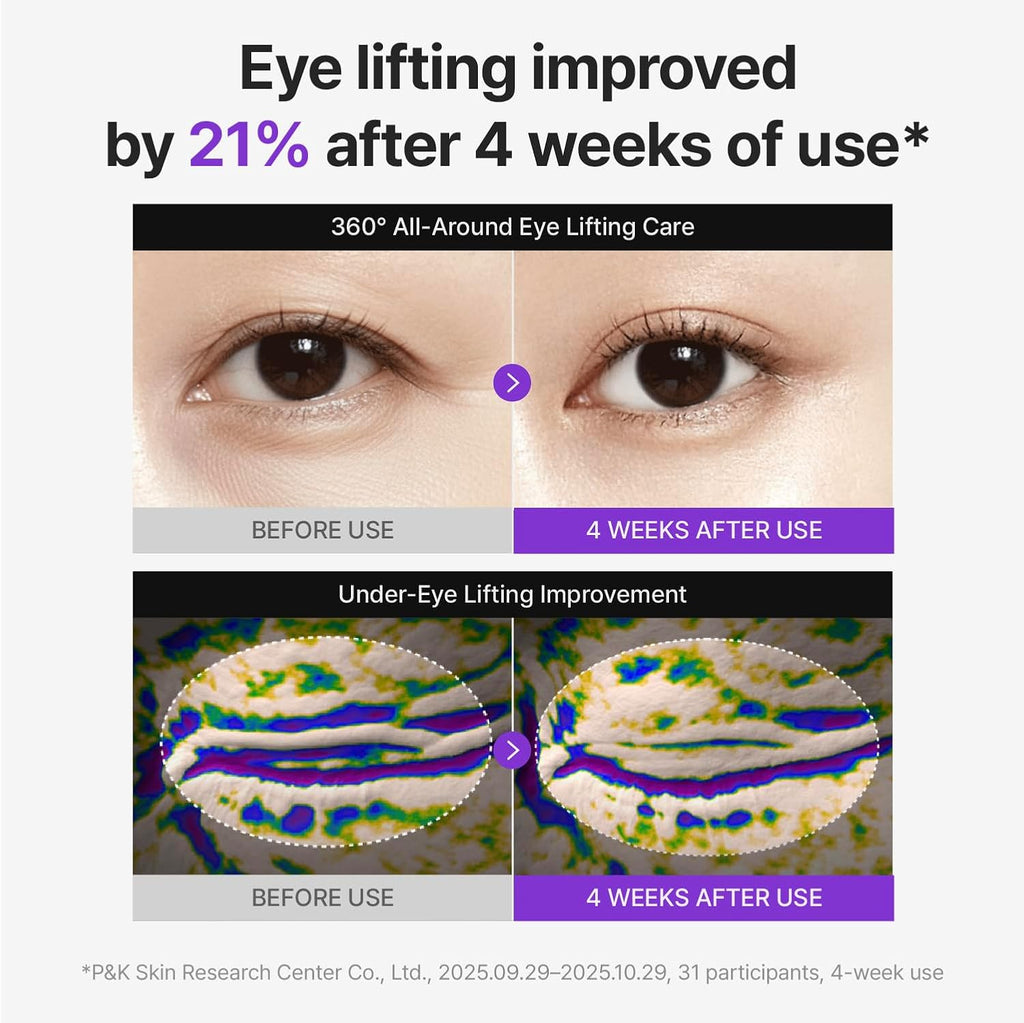360º Shot PDRN Eye Cream - TECA, Retinol and Collagen | Targets Wrinkles, Crow's Feet, Dark Circles, Puffiness and
