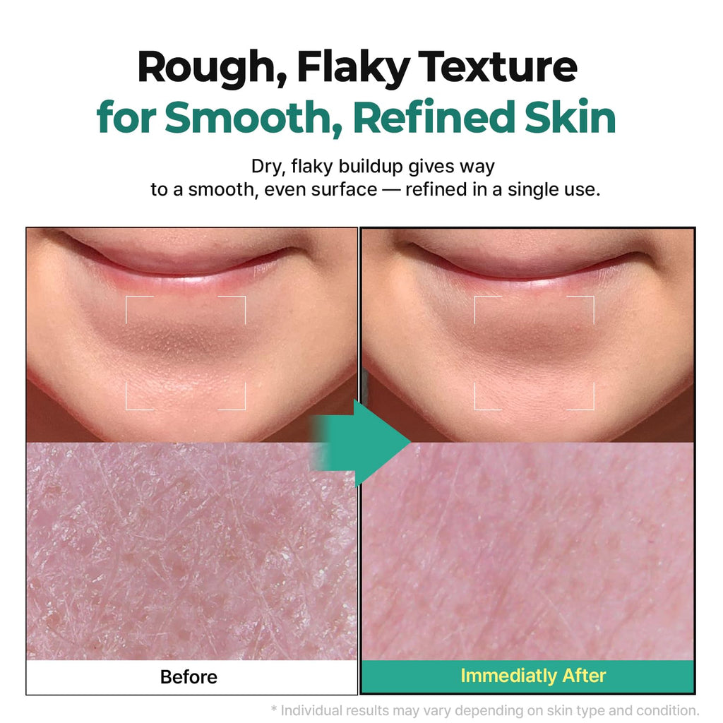 LHA Green Tea Exfoliating Aqua Peel Gel, Deep Pore Face Exfoliant, Gentle Facial Exfoliator, Dead Skin Remover