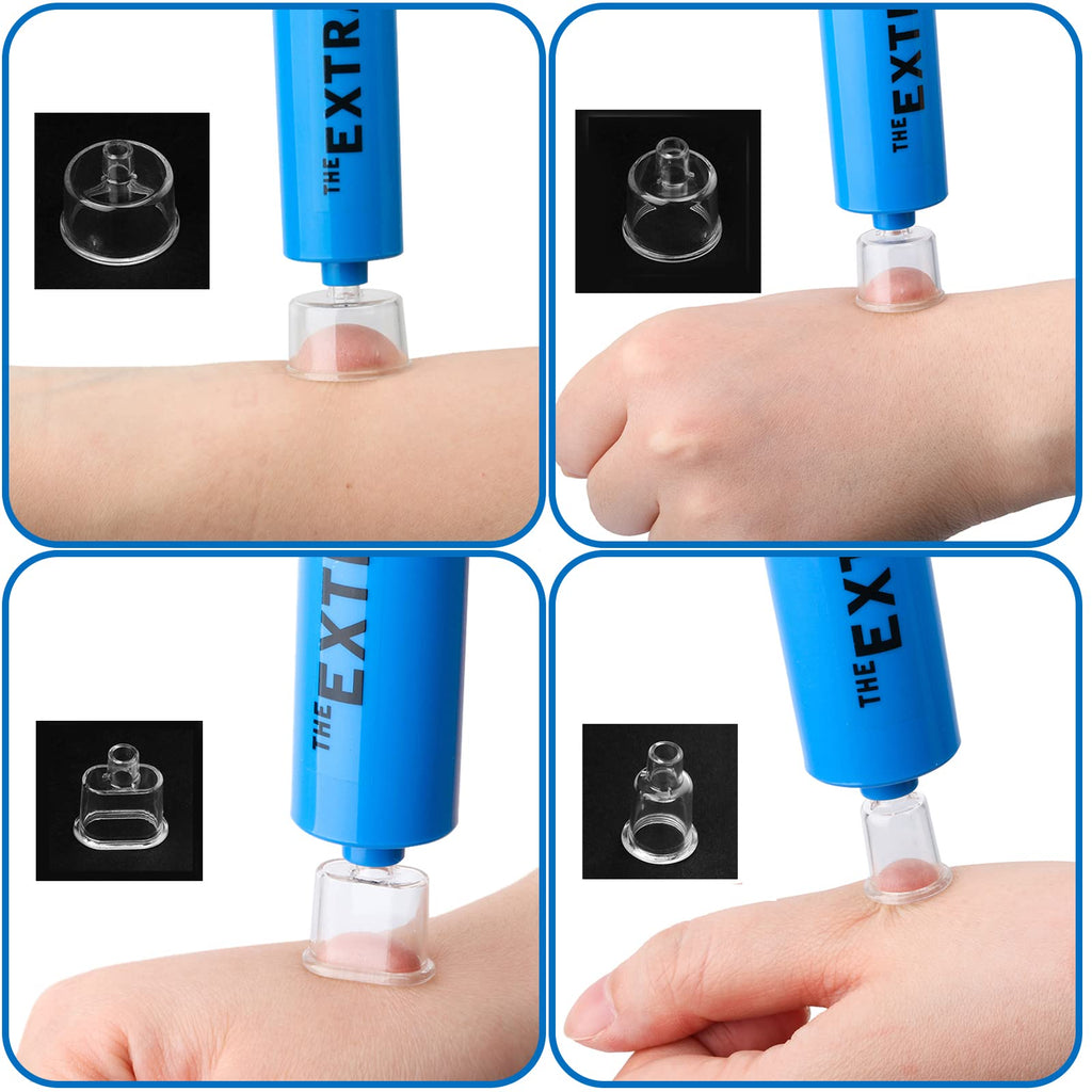 Snake Bite Kit Venom Extractor Suction Pump Bee Sting Kit, Blue