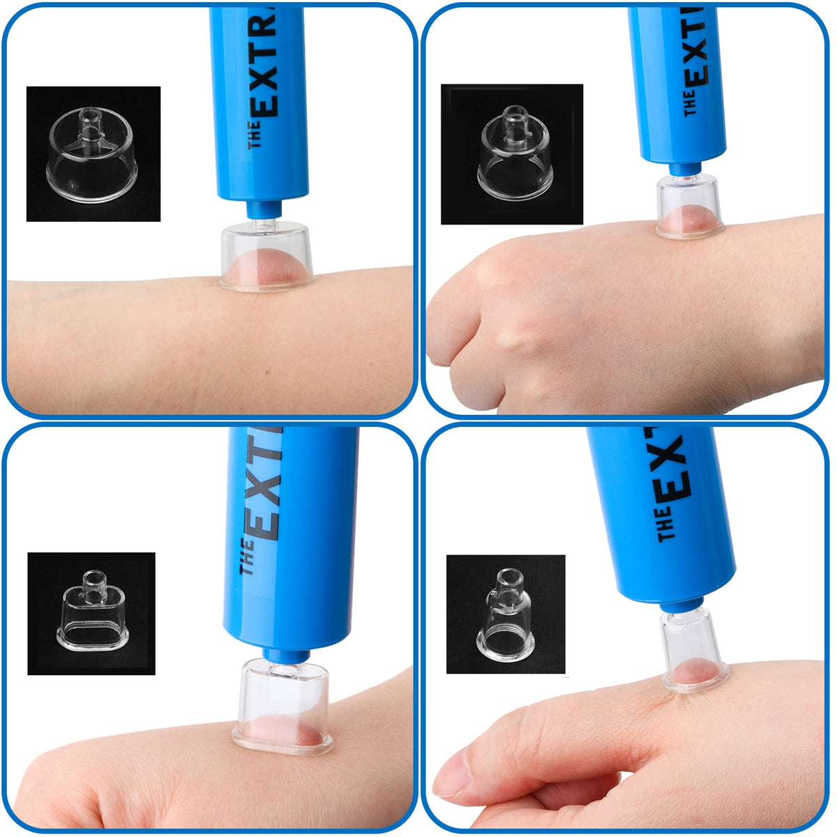 Snake Bite Kit Venom Extractor Suction Pump Bee Sting Kit, Blue