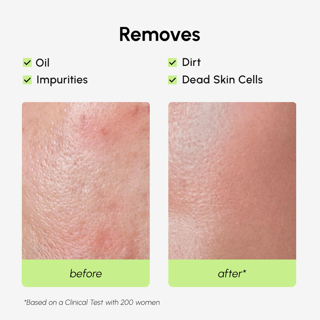 Exfoliating Salicylic Acid Toner for Face Exfoliator Pore Cleaner