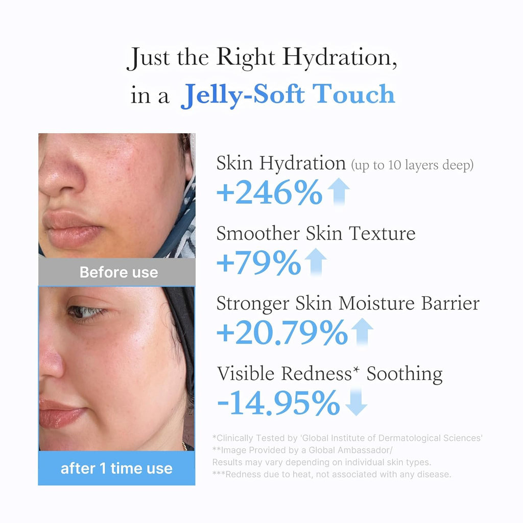 Jelly Cream with Hyaluronic Acid for Long-lasting Hydration | Daily Moisturizer with Hyaluronic Acid, Ceramides
