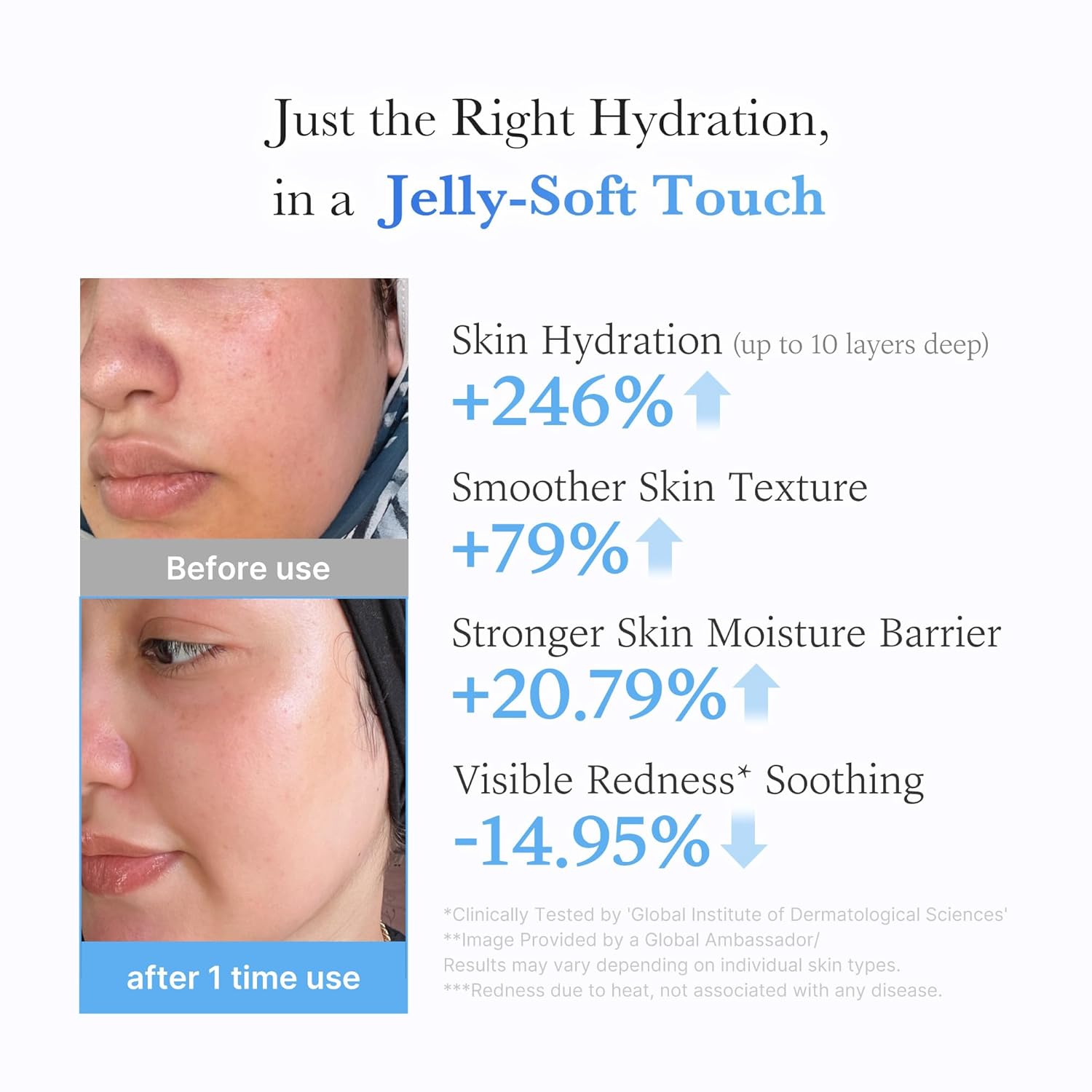 Jelly Cream with Hyaluronic Acid for Long-lasting Hydration | Daily Moisturizer with Hyaluronic Acid, Ceramides