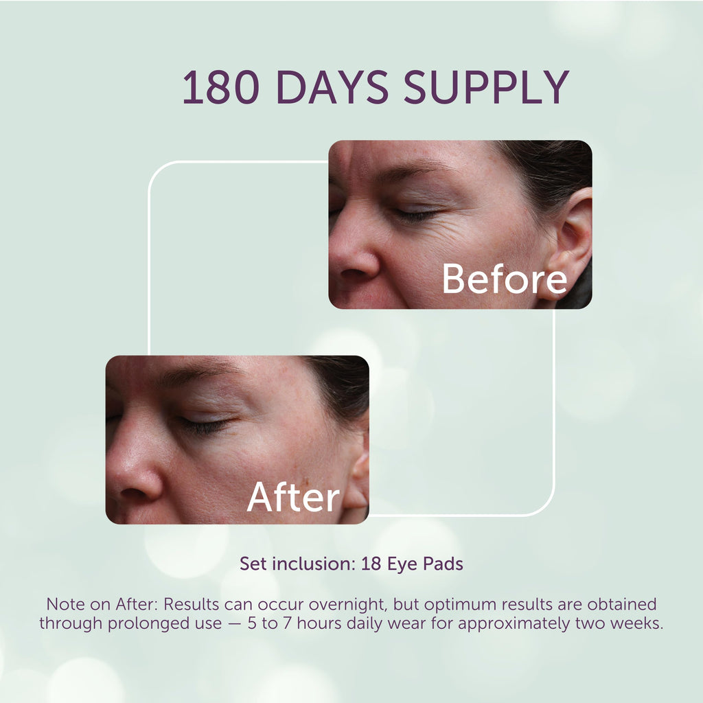 Silicone Eye Pads For Fine Lines, 180 Day Supply