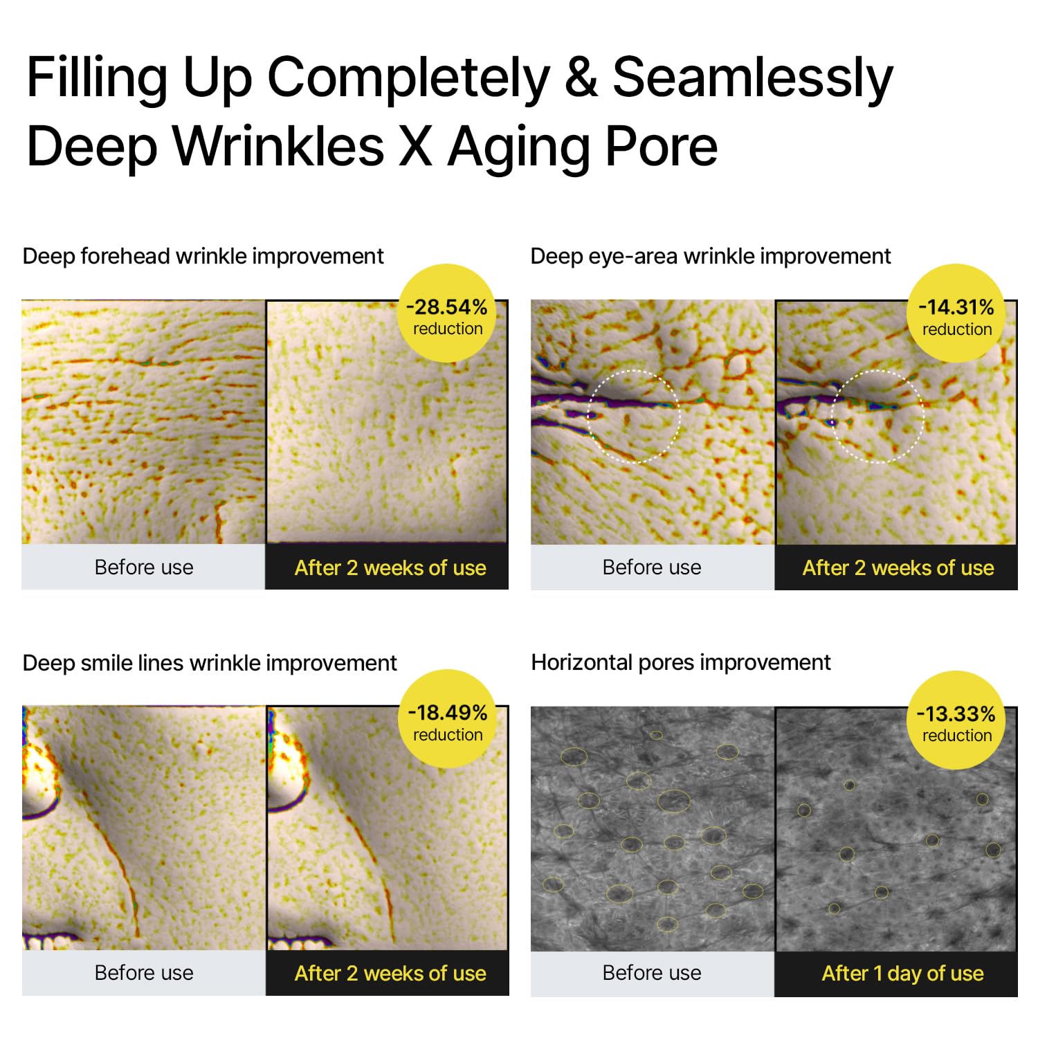 The Vita A Retinal Shot Tightening Booster | 0.1% Retinal, 3% Matryxyl, High-Strength Retinoid for Anti-Aging, Pore