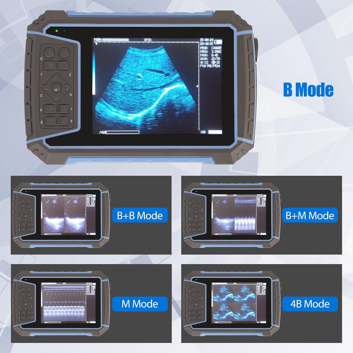 2025 Upgraded Veterinary Ultrasound Machine - with 3.5MHz Convex Probe, Pregnancy Portable Handheld Scanner B-Ultra
