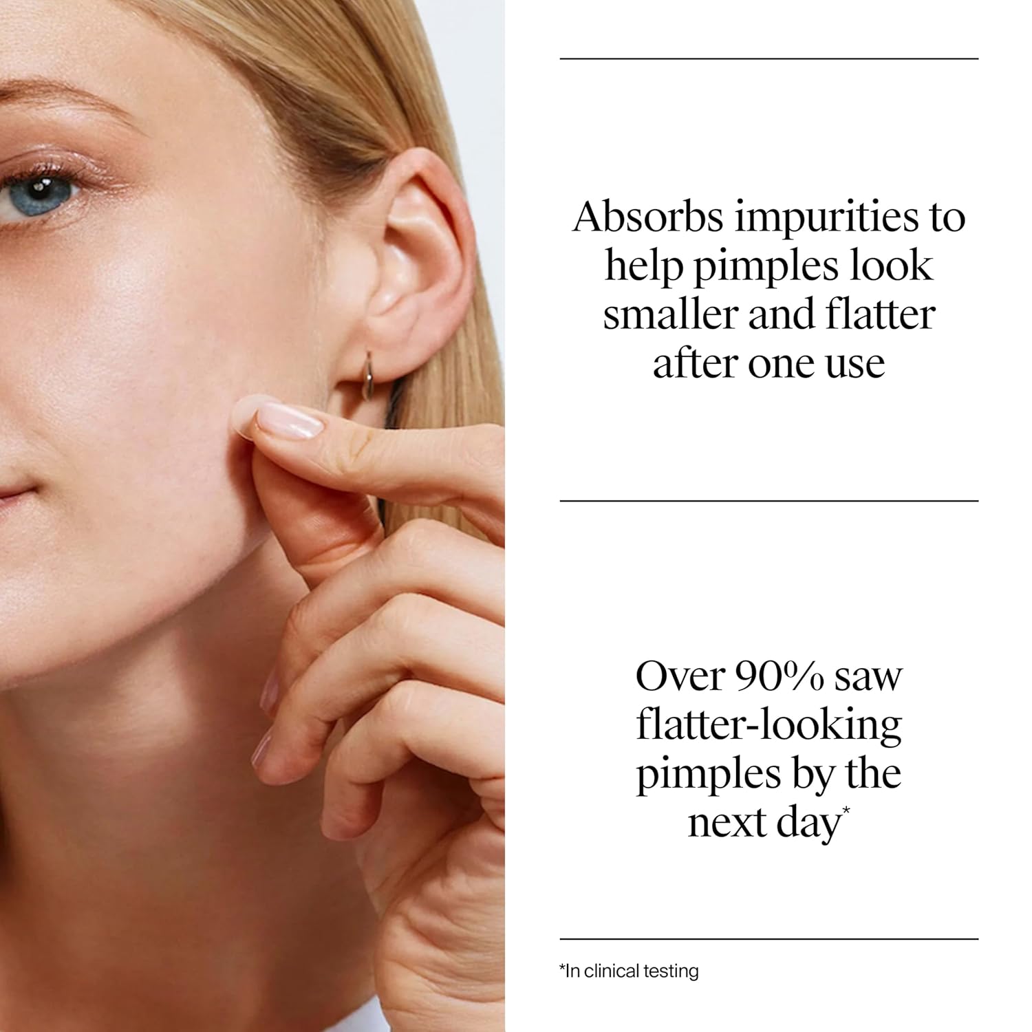 Stubborn Acne Patches, Ultra-Thin Pimple Patches, 24 Ct | Hydrocolloid Absorbs Impurities, Ultra-Thin, Works
