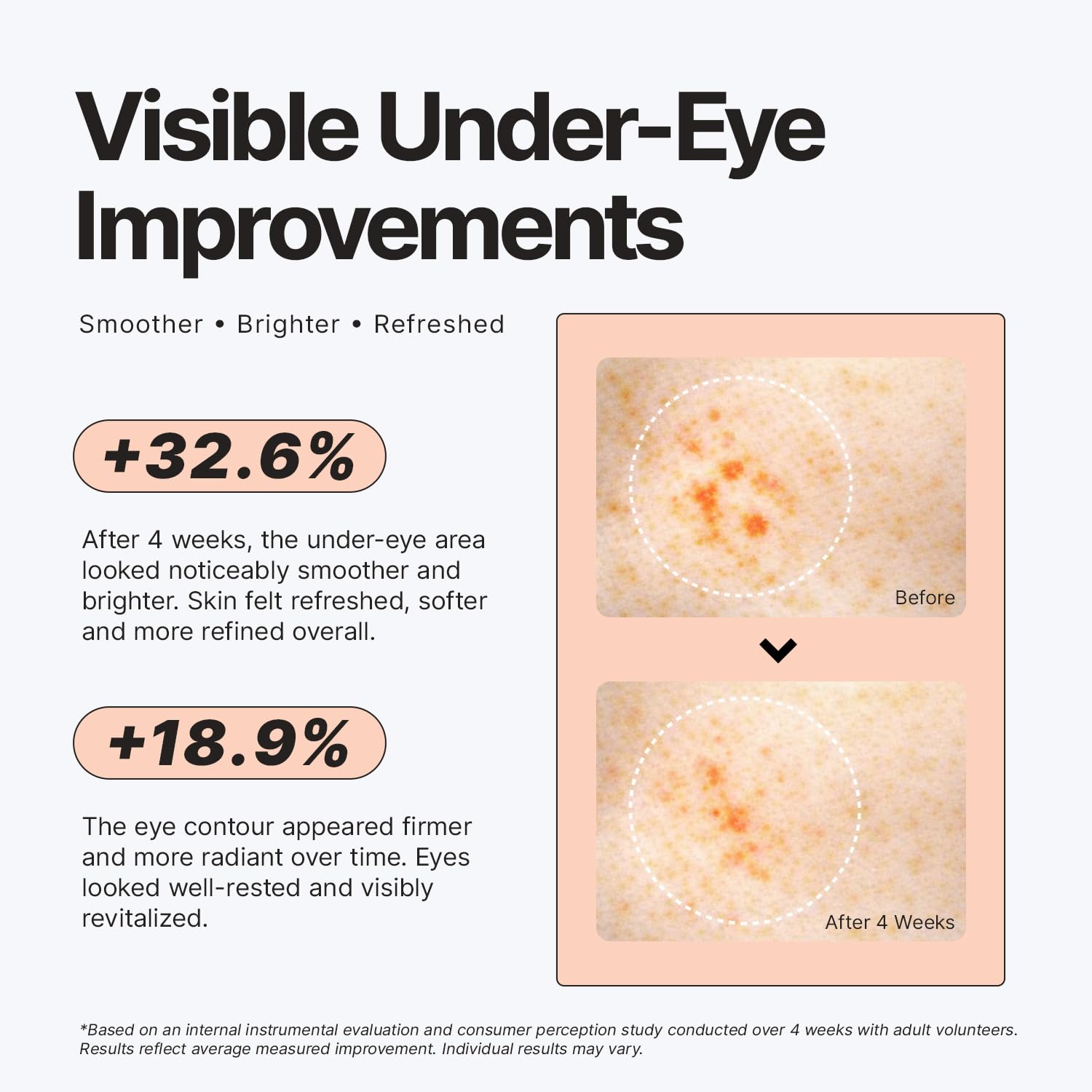 PDRN Under Eye Patches for Dark Circles & Puffiness - Korean Skin Care Hydrogel Eye Mask Salmon DNA, Peptide, Retinol