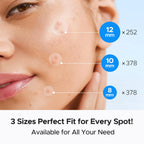 Pimple Patch Bulk, 1008 Patches 3 Size Acne Patches for Face