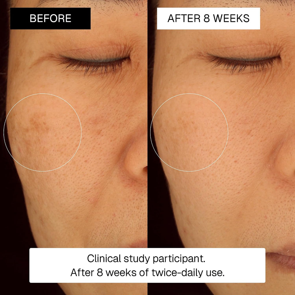 3-Step Dark Spot & Fine Lines System - Korean Skincare for Dark Spots, Wrinkles & Dull Skin - Facial Treatment with