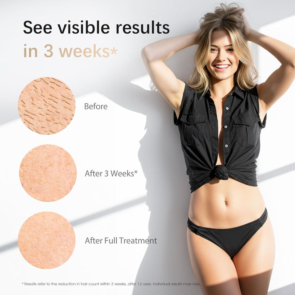 IPL Laser Hair Removal Device for Women & Men - Safe At-Home 45°F Ice-Cooling Contact for Painless & Long-Lasting