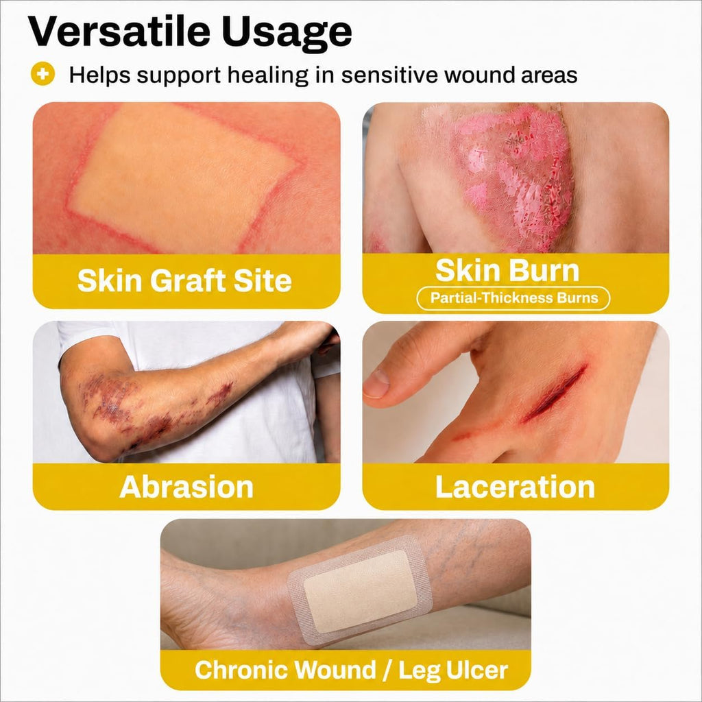 Xeroform Petrolatum Dressing, Non-Adherent, 5x9 in, 25 Count | Sterile Fine Mesh Gauze Pads for Burns, Skin Grafts