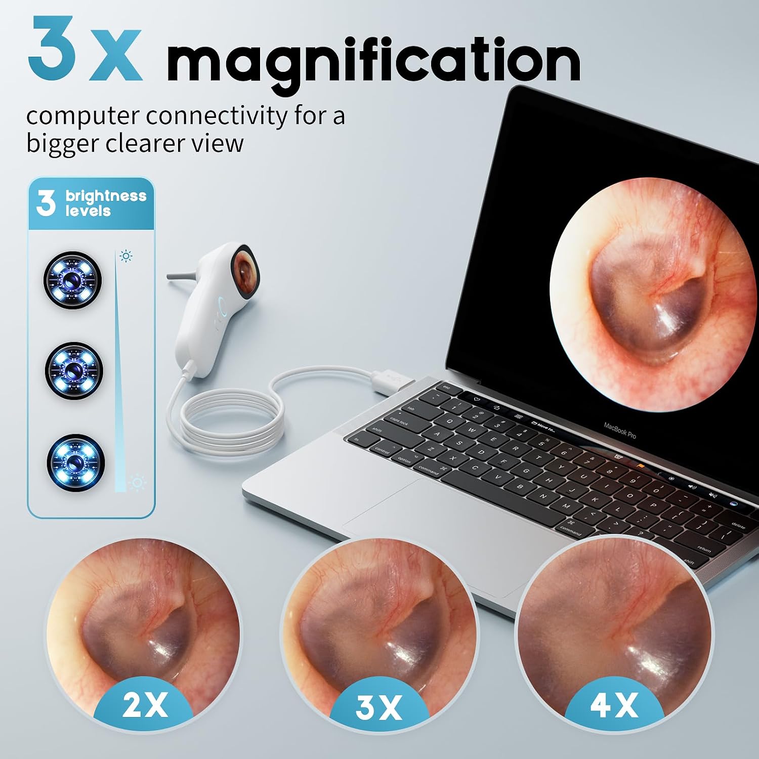 Otoscope Ear Camera with 1.21” Screen, 1080P Ear Scope with 4 LED Lights, Otoscope Camera for Adults, Support Photo &