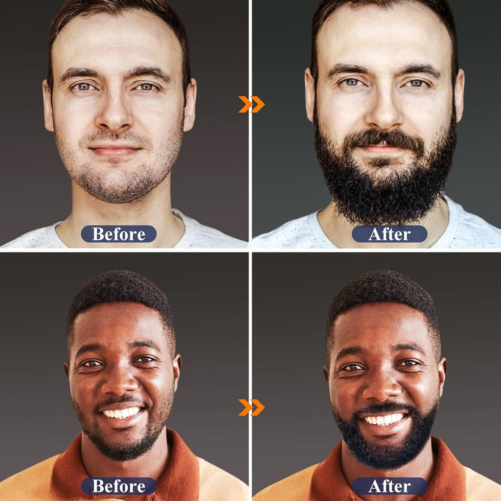 Beard Kit, Beard Growth Kit w/Natural Ingredients Beard Oil & Balm & Comb, Beard Growth Oil w/4X Thickening Biotin
