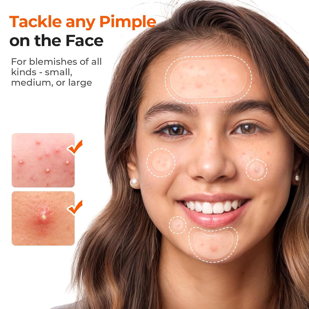609 Count Pimple Patches for Face, Hydrocolloid Acne Patch Bulk, Acne Stickers for Covering Cheeks, Forehead, Chin