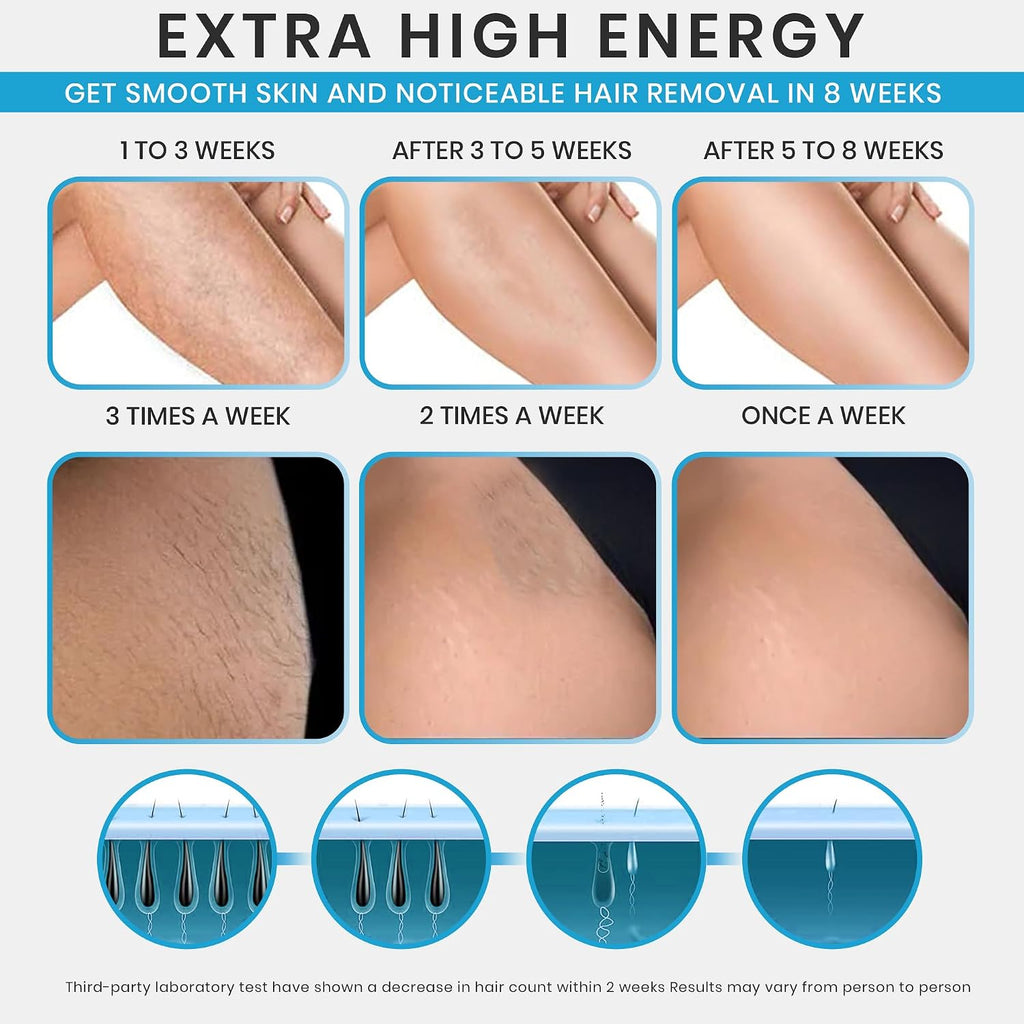 IPL Laser Hair Removal Device- Permanent Facial, Face, Chin, Upper Lip, Legs, Bikini Line, Pubic & Private Area Hair
