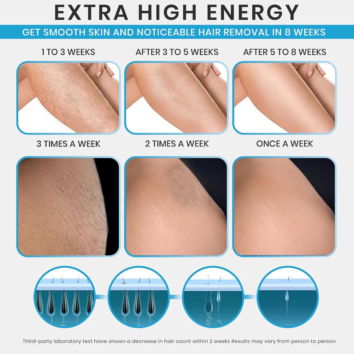 IPL Laser Hair Removal Device- Permanent Facial, Face, Chin, Upper Lip, Legs, Bikini Line, Pubic & Private Area Hair