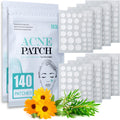 Pimple Patch Acne Patch, 4 Sizes 280 Patches Acne Absorbing Cover Patch, Hydrocolloid Invisible Acne Patches for Face