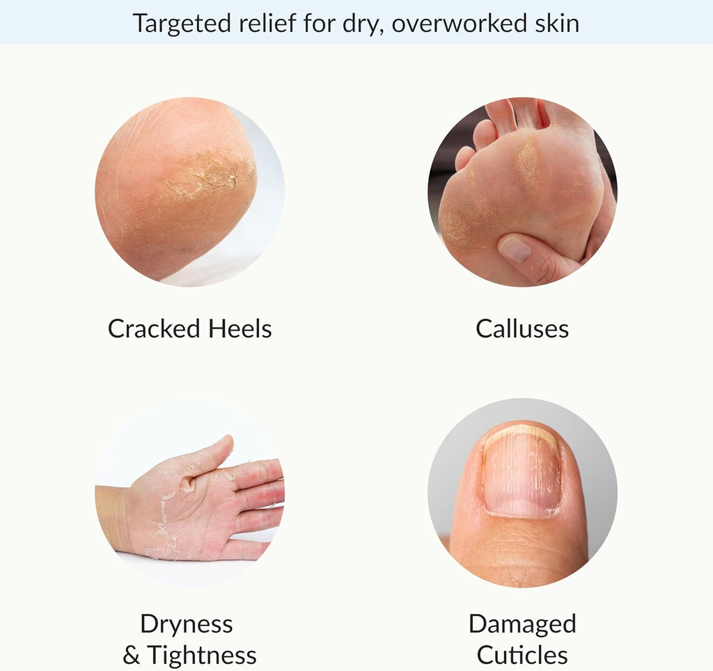 Intensive Repairing Hand & Foot Masks, Restore and Moisturize Dry, Cracked Skin, Self Care Gifts for Women, Spa Kit