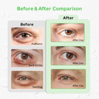 4PCS Gel Eye Ice Pack Set Reusable, Cold and Hot Compress for Eyes