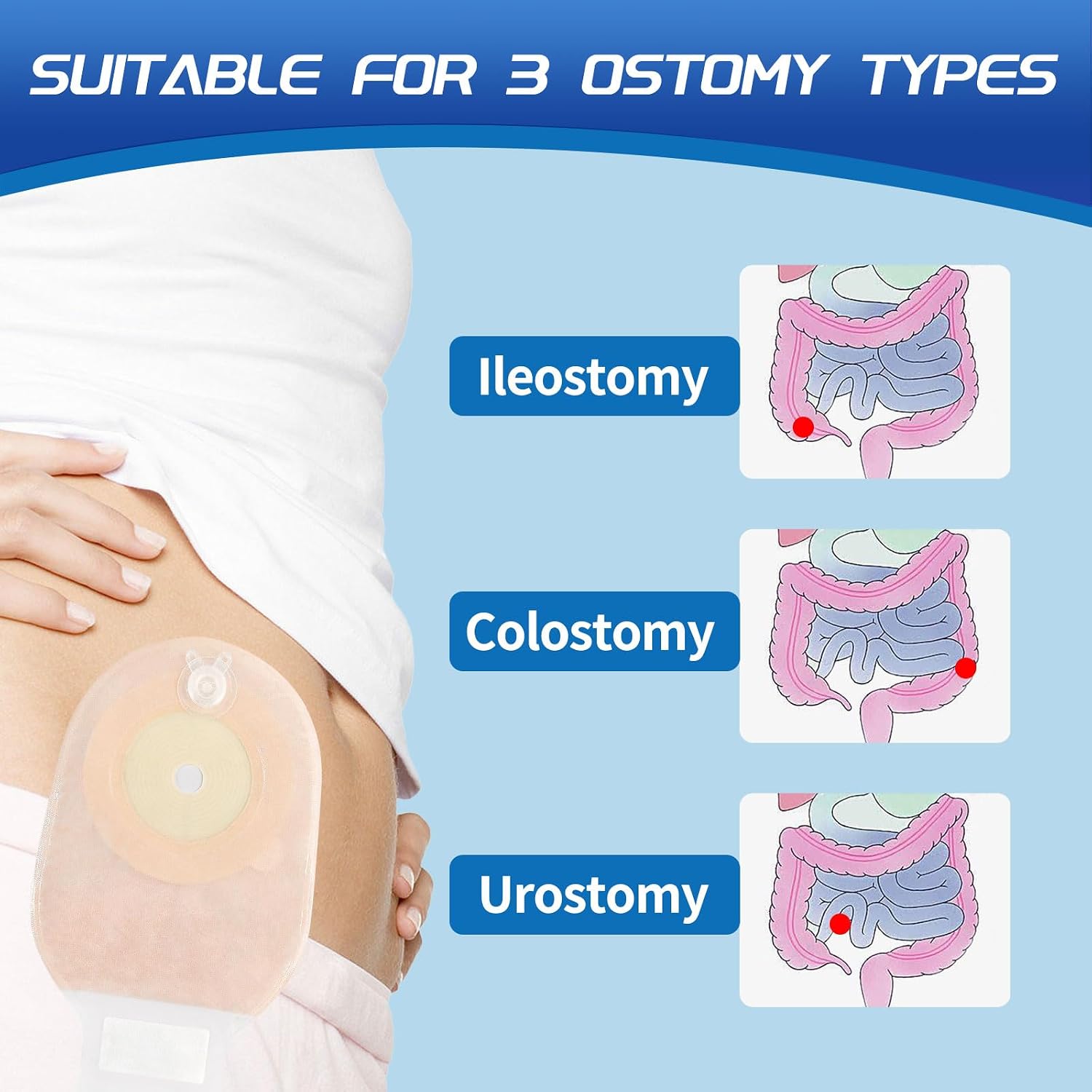 One Piece Colostomy Bags,20-65mm Cut-to-Fit,A001-4(20PCS)