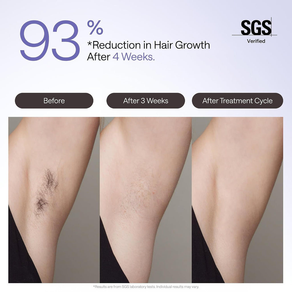 Laser Hair Removal Device Air 4 Ipl Gift for Women and Men, Ice Cool and Permanent Hair Reduction for Nearly