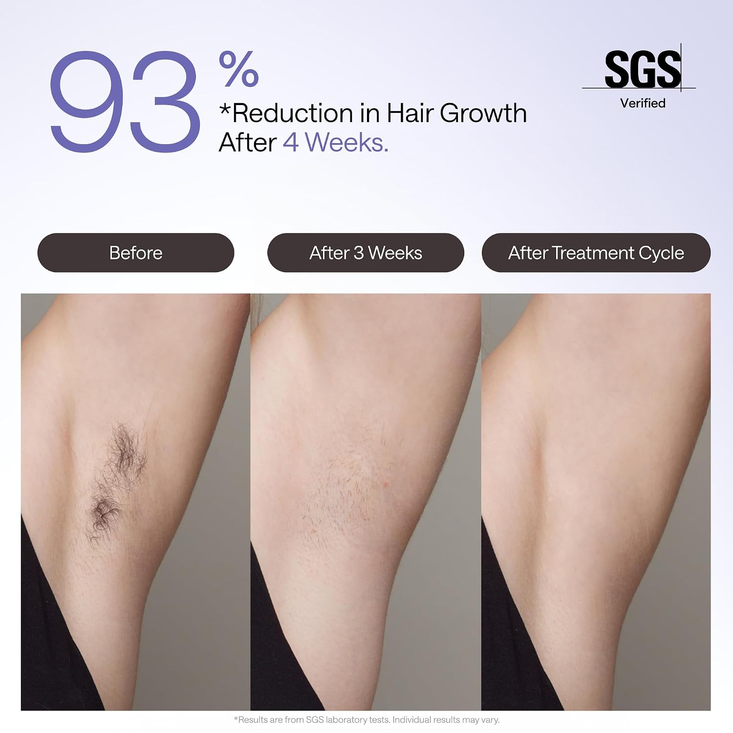 Laser Hair Removal Device Air 4 Ipl Gift for Women and Men, Ice Cool and Permanent Hair Reduction for Nearly