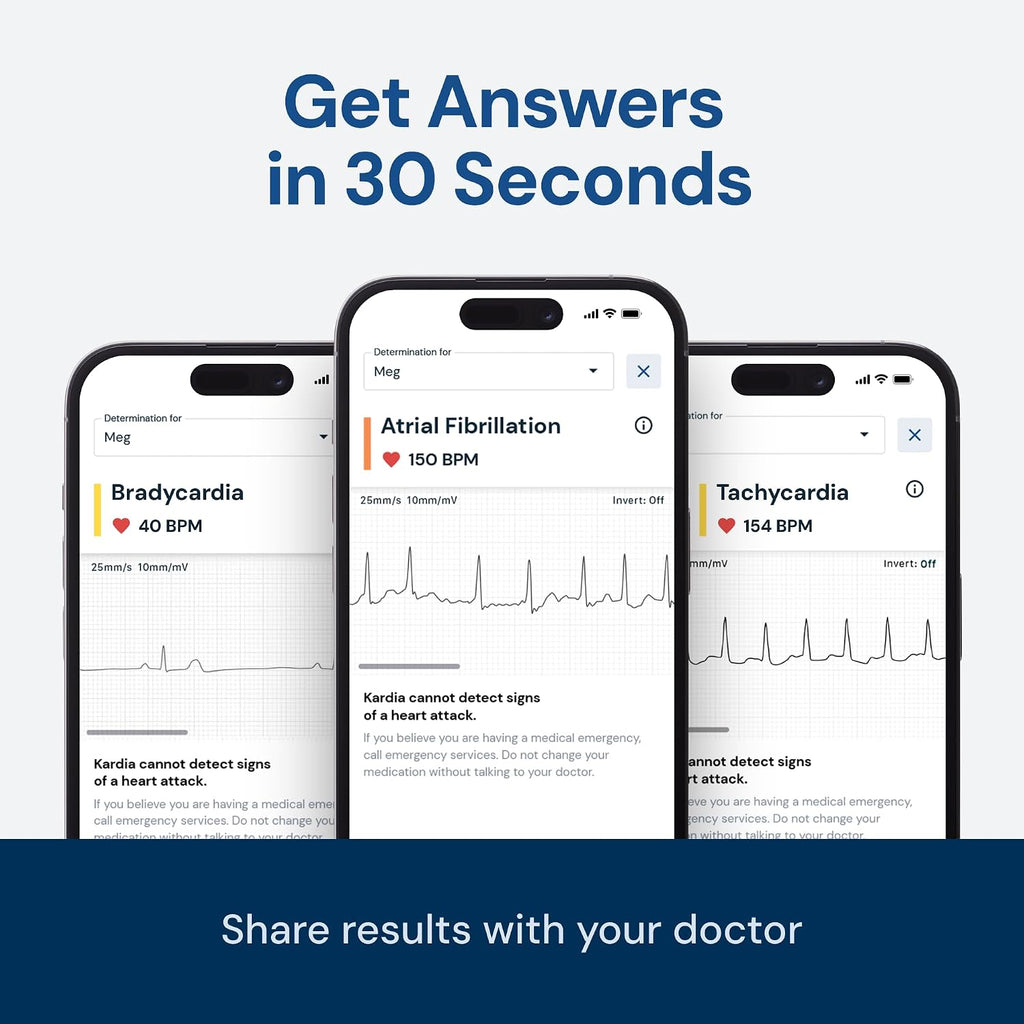 1-Lead EKG Monitor, Medical-Grade FDA-Cleared Personal Heart Monitor, Detects Normal, AFib & Arrhythmias, 30 Second