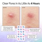 Award Winning Pimple Patches for Face -72 Pack Multishape