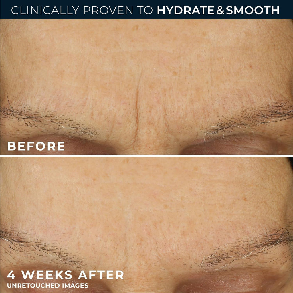 Retinol Correxion Max Hydration Anti-Aging Daily Face Moisturizer with Hyaluronic Acid, Fragrance-Free, Oil Free Skin