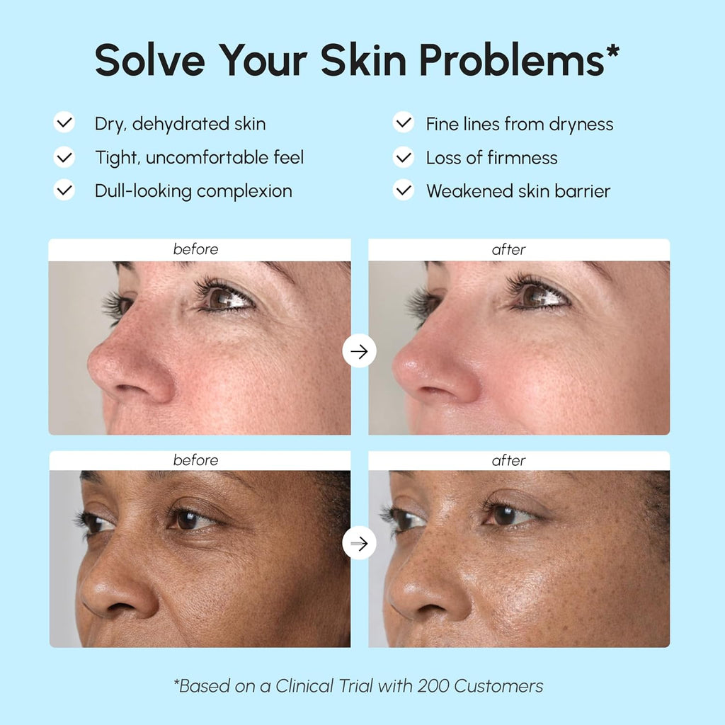 Face Moisturizer – Firming & Lifting Face Cream for Women with Collagen, Retinol & Hyaluronic Acid – Day & Night