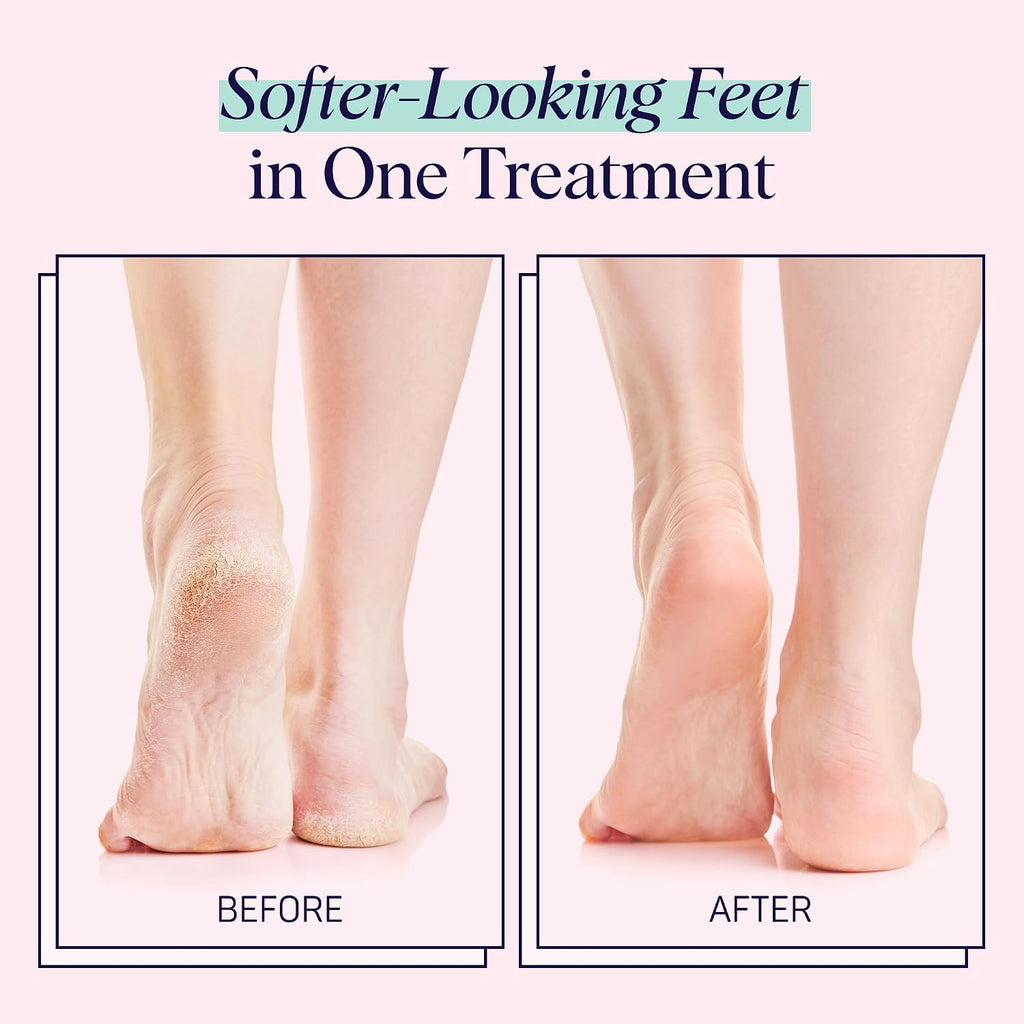 Moisturizing Foot Sockies | Foot Mask for Dry Cracked Feet | Tea Tree Oil Softening Booties | Callus Remover