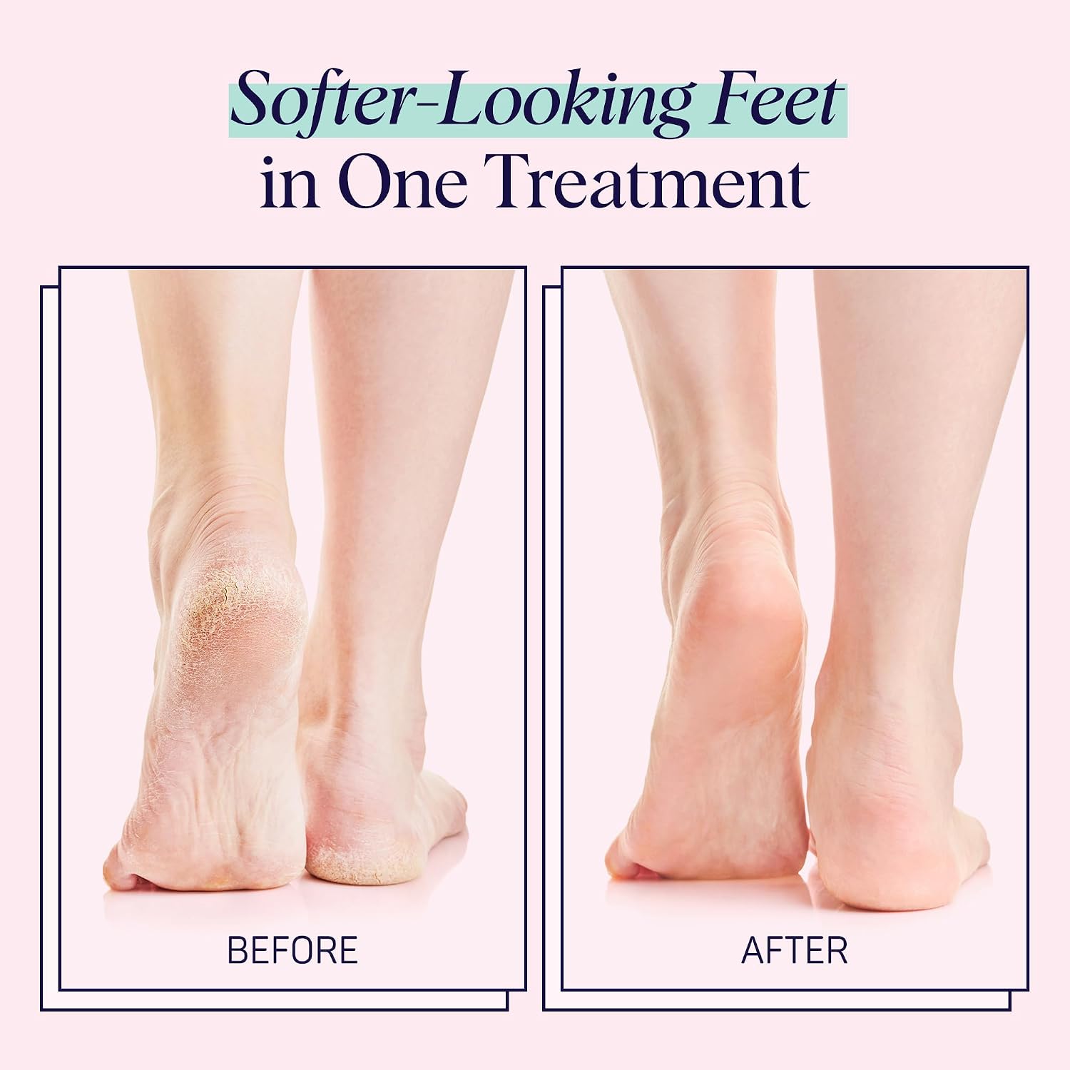 Moisturizing Foot Sockies | Foot Mask for Dry Cracked Feet | Tea Tree Oil Softening Booties | Callus Remover