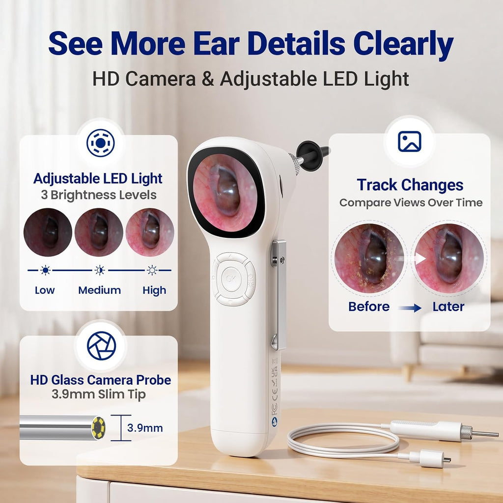 Otoscope with Light, No App Needed, HD Screen, Ear Scope Camera for Family | Ear Camera with Earwax Removal Kit for
