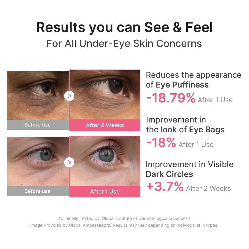 Eye Patch PDRN Caffeine Collagen | Gel Eye Patches for the appearance of Dark Circles, Undereye Bags | Firming