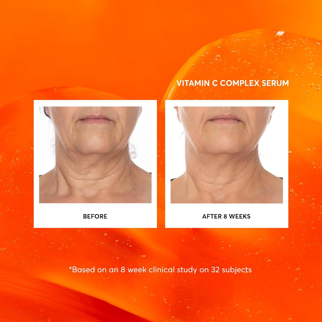 Vitamin C Complex Face Serum, Plus Hyaluronic Acid & Vitamin E, Anti Aging Skin Care Treatment, 1 oz