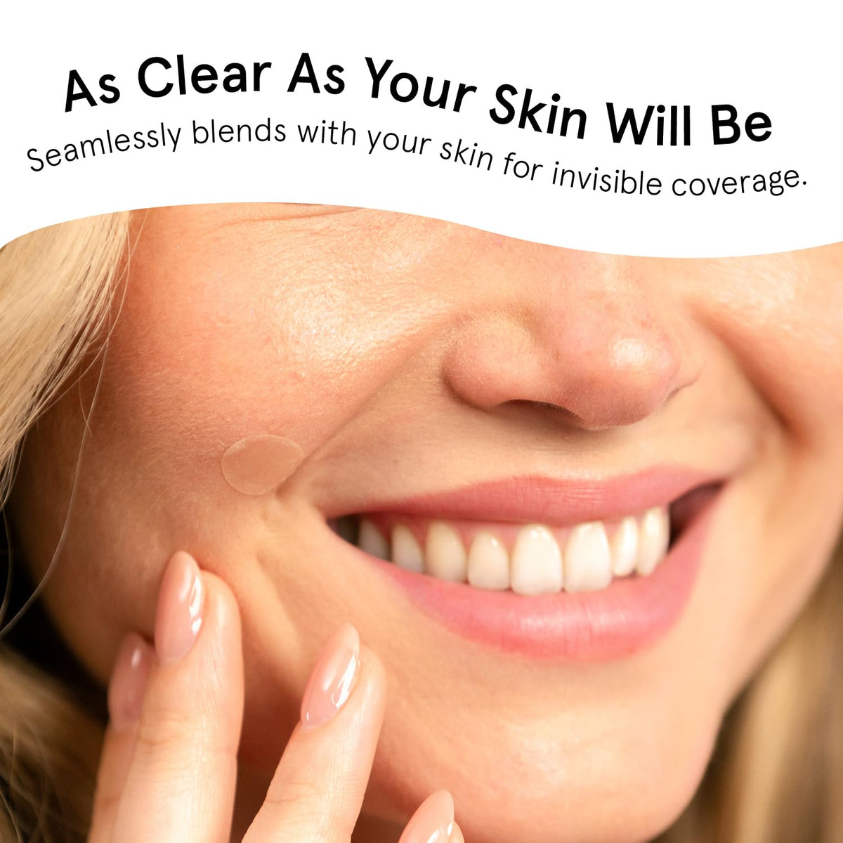 Award Winning Multi-Size Pimple Patches for Face