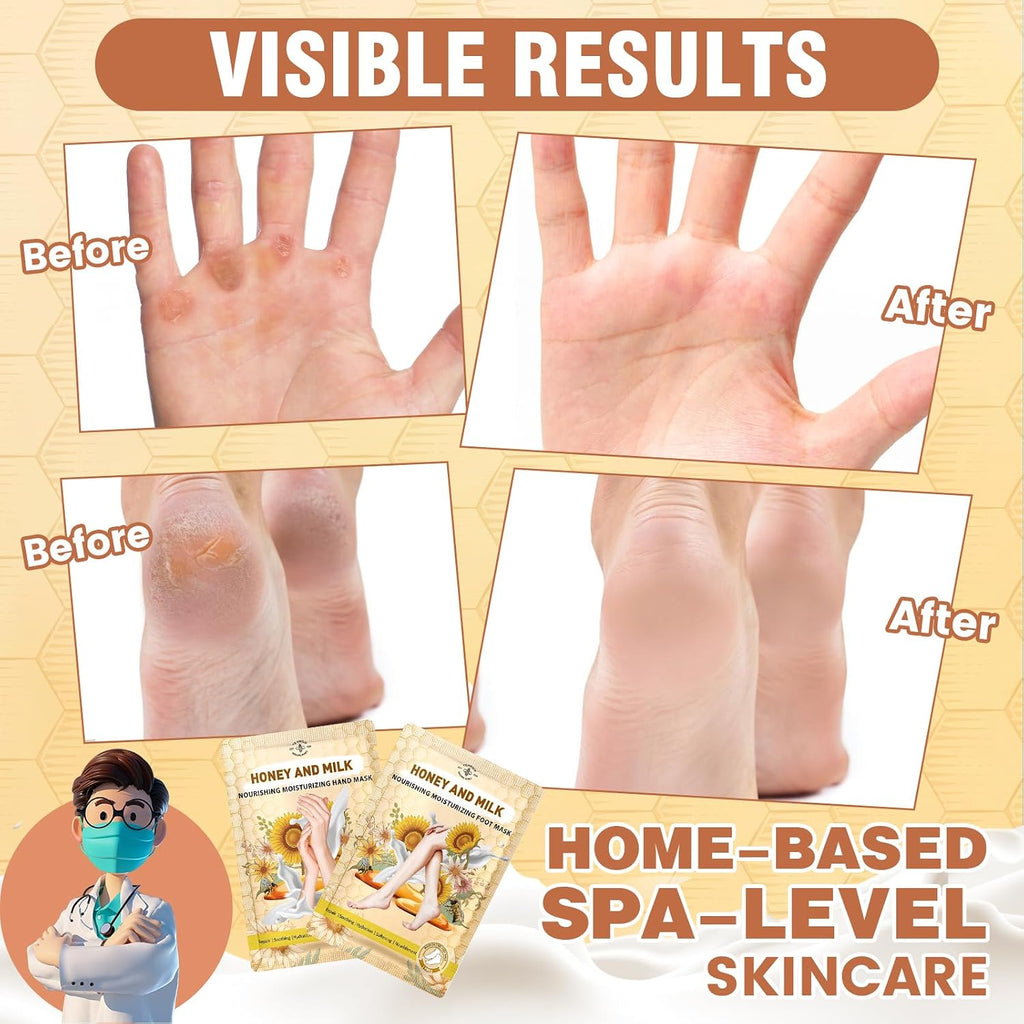 Hydrating Hand and Foot Mask with Honey & Milk, Vitamin E | Moisturizing Socks for Dry, Cracked Heel, Foot Spa, Honey