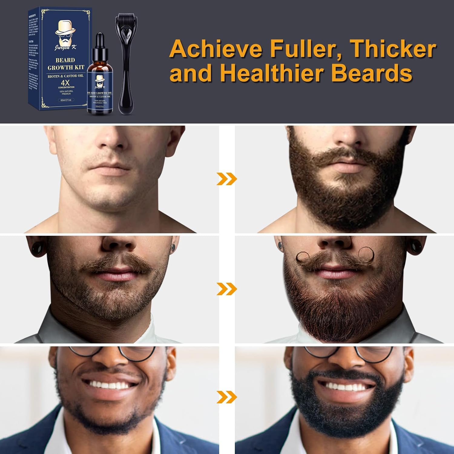 Beard Growth Kit, Beard Growth Oil (2Oz) w/Biotin & Castor Oil, Beard Massager for Patchy/Spot Beard, Beard Kit for