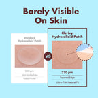Hydrocolloid Pimple Patches, Salicylic Acid & Phytosphingosine (72 Count)