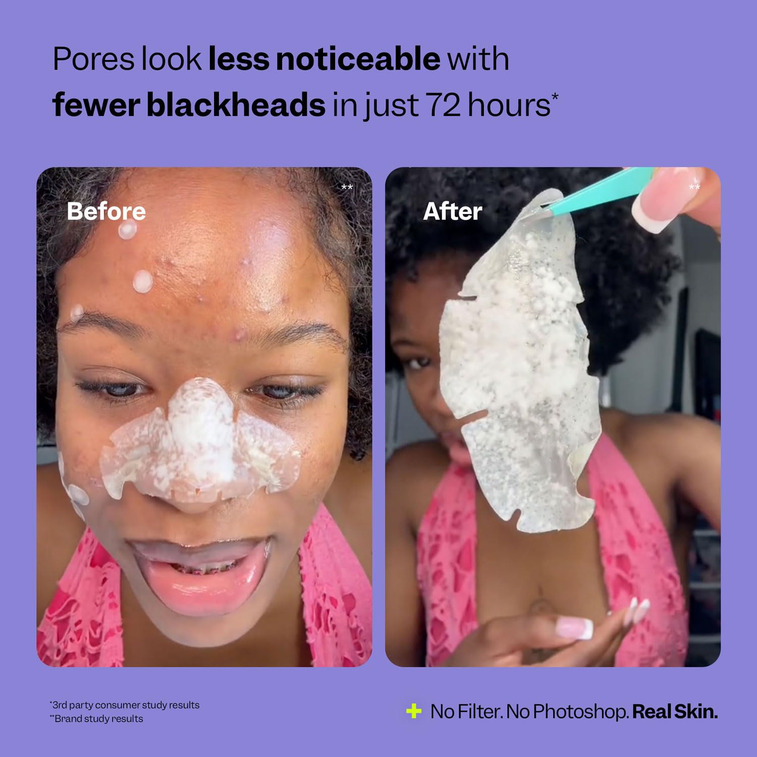 Nose Pore Patches (7 ct) - Overnight Blackhead Remover - Pore Strips - Absorbs Gunk - Thin, Flexible & Painless