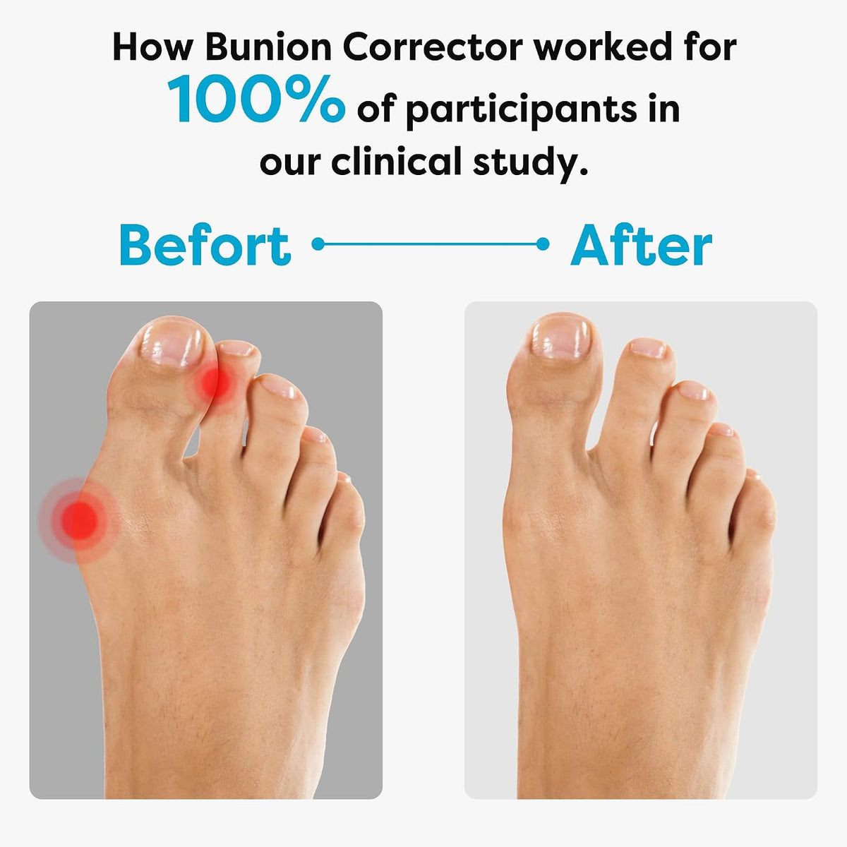 Bunion Sleeves for Women and Men, Soft Gel Pads with Heel Straps, 4 Sizes