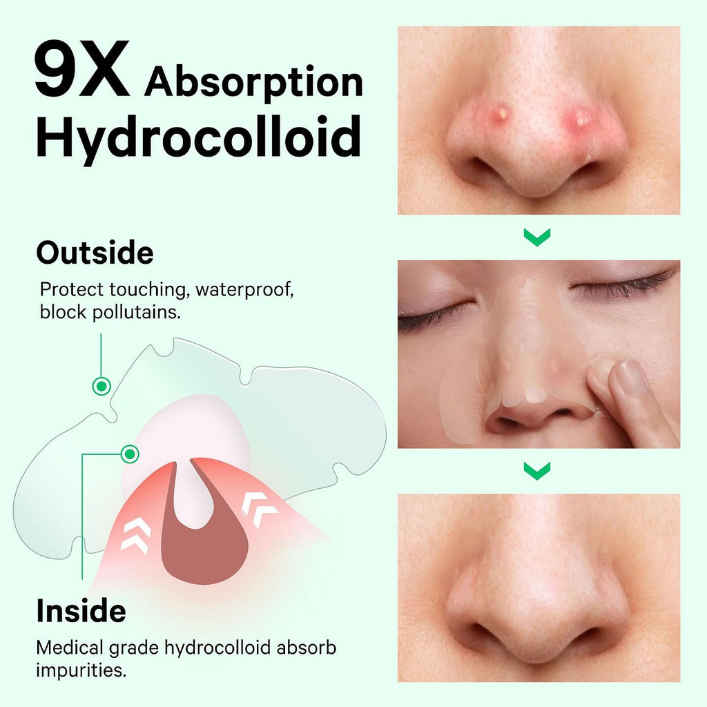 Hydrocolloid Pimple & Pore Patches for Nose, Absorb Oil Overnight, Target Pimples, Zits and Pores, FSA Eligible Acne